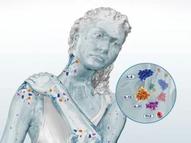 아토피피부염과 제2형 염증