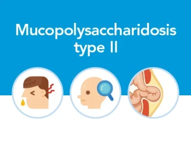 뮤코다당증 제2형이란?