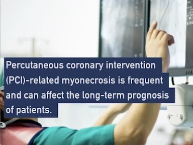 Clopidogrel as the standard of care for elective PCI: Findings from the Alpheus