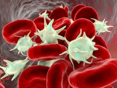 2019 ESC Guidelines for Acute Pulmonary Embolism