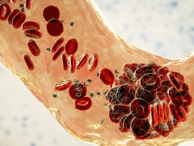 Specific Patient Characteristics Linked to Below Average Quality of Life in Patients with Recent Venous Thromboembolism (VTE)