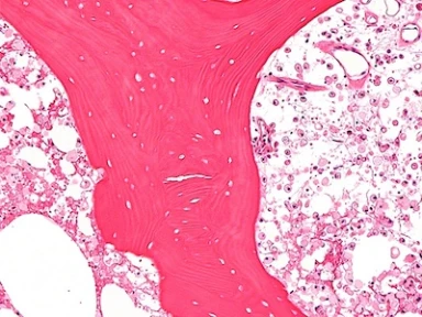 HAVE YOU HEARD ABOUT ARGENTINE BONE PROJECT?