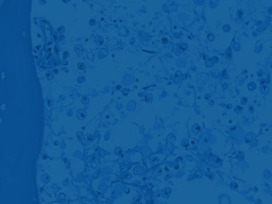 PREGNANCY OUTCOMES IN IMIGLUCERASE-TREATED PATIENTS WITH GAUCHER DISEASE: REAL-WORLD DATA FROM INTERNATIONAL COLLABORATIVE GAUCHER GROUP (ICGG) GAUCHER REGISTRY