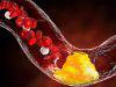 Is Clopidogrel a viable first choice P2Y12 inhibitor for DAPT after PCI?