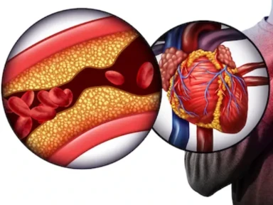 Rôle de médicaments hypolipémiants dans la prévention secondaire de la maladie  cardiovasculaire athérosclérotique chez les patients atteints de diabète sucré