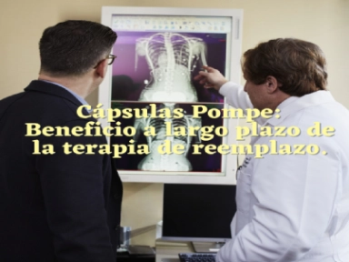 Pompe: beneficio de la terapia de reemplazo 