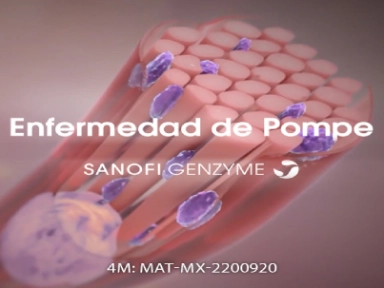 La enfermedad de Pompe 