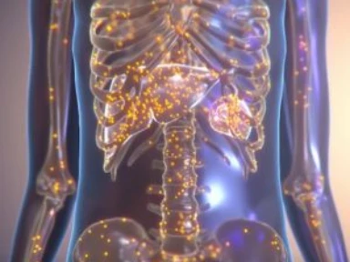 ¿Qué es la Enfermedad de Gaucher?