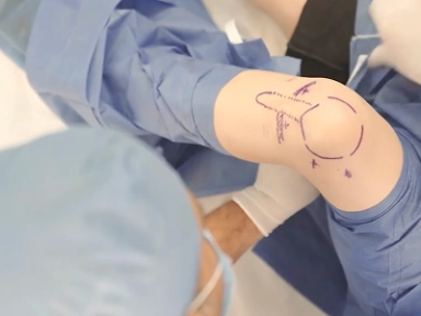 Master Class - Dr. Raghu Raman: Rodilla II