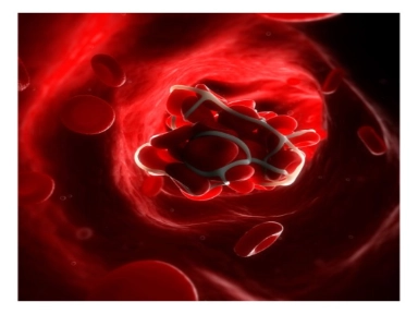 Enfermedad tromboembólica venosa y tromboprofilaxis