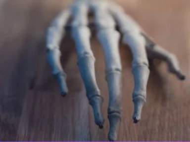 Manifestaciones óseas de pacientes con enfermedad de Gaucher tipo 1