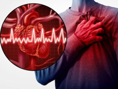 Effect of de-escalated P2Y12 inhibitor switching in dual antiplatelet therapy (DAPT)