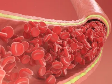 Lipid-Lowering Therapy and Achievement of Lipid Targets ESC and EAS Guidelines