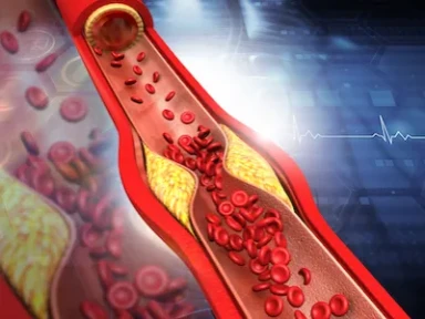Prognostic impact of achieving LDL cholesterol guidelines