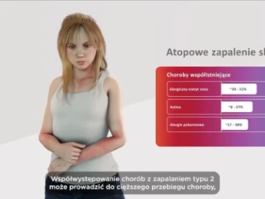 Zapalenie typu 2 - mechanizm choroby