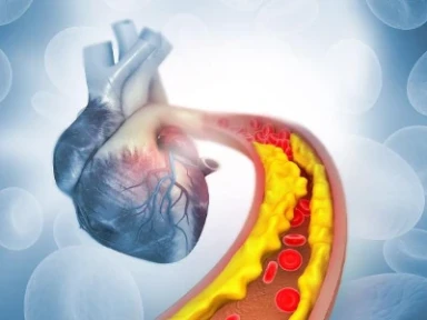 Zastosowanie inhibitorów PCSK9 w praktyce klinicznej AT TARGET IT