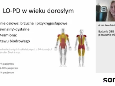 Badania DBS w chorobach pierwotnie mięśniowych - dr hab. n. med. Anna Potulska-Chromik