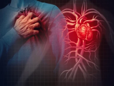 Trwająca miesiąc podwójna terapia przeciwpłytkowa (DAPT), a następnie monoterapia klopidogrelem w OZW