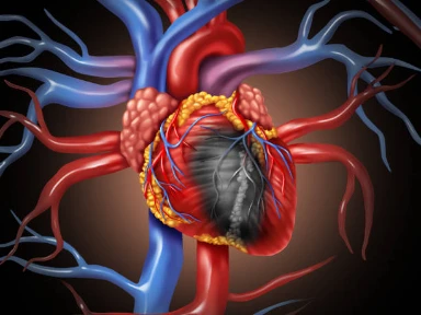 Strategie podwójnej terapii przeciwpłytkowej u pacjentów z zawałem