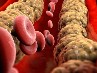 Terapia hipolipemizująca przez okres do roku po OZW