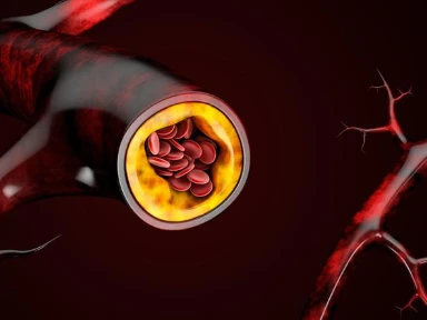 Terapia hipolipemizująca w ciągu pierwszych 3 miesięcy po ostrym zawale