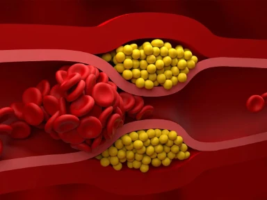 II Kongres Immunologii Sanofi: Przełomowe Osiągnięcia i Nowe Perspektywy