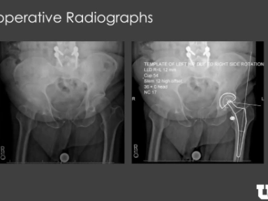 Atlas podstawowych zabiegów ortopedycznych  