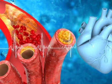 Osiągnięcie docelowych poziomów cholesterolu LDL