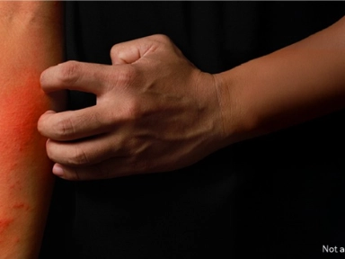 Poprawa jakości życia pacjentów z niekontrolowanym atopowym zapaleniem skóry (AZS): Narzędzia do szybkiej identyfikacji i oceny leczenia