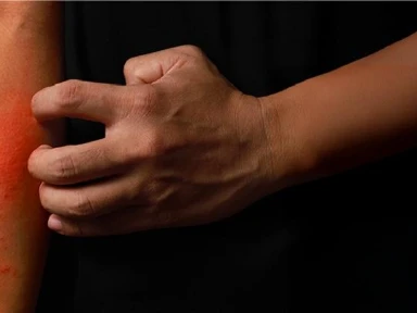 Poprawa jakości życia pacjentów z niekontrolowanym atopowym zapaleniem skóry (AZS): Narzędzia do szybkiej identyfikacji i oceny leczenia