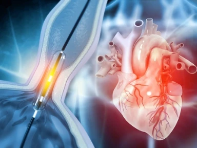 Wpływ ciężkiego krwawienia i nawracającego zawału mięśnia sercowego na śmiertelność u pacjentów poddawanych PCI