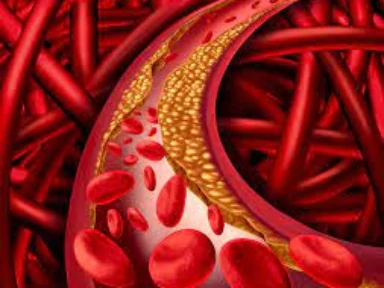 Zmieniające się potrzeby i wyzwania związane z osiągnięciem docelowych poziomów stężenia cholesterolu LDL-C