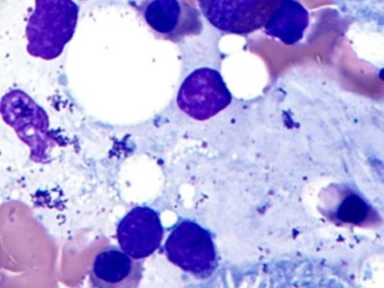 Classificação da doença