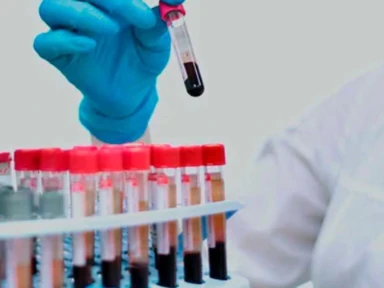 Teste de diagnóstico e confirmação