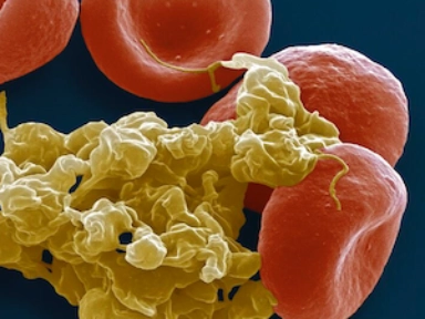 VTE Safety Zone: VTE in general surgery from risk assessment to appropriate thromboprophylaxis