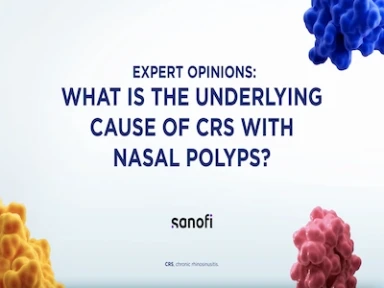 Type 2 Inflammation is the underlying cause of CRSwNP in 80% of Patients.