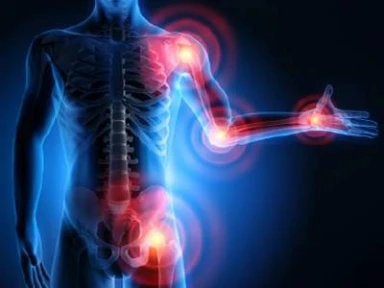 Expert Group Consensus From The Arabian Peninsula On The Diagnosis Of Late Onset Pompe Disease for orthopedists