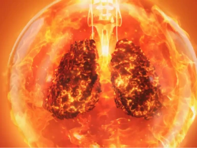 Påverkan av exacerbationer vid KOL