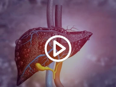 Cerezyme Karaciğer ve Dalak Üzerine Etkililik