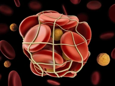 Varfarin ile Artial Fibrilasyon ve KAH Yönetimi