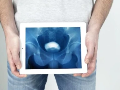 BPH’ye Bağlı AÜSS Tedavisi: AUA Cerrahi Tedavi Kılavuzu