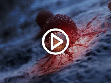 Cerezyme 5 Yıl Hematolojik Etkililik