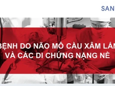 Bệnh Do Não Mô Cầu Xâm Lấn Và Các Di Chứng Nặng Nề