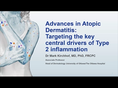Advances in Atopic Dermatitis: Dr. Mark Kirchhof