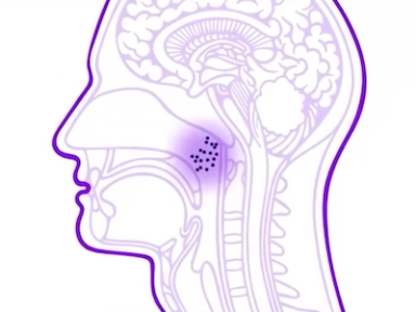 IMD symposium - Full Symposium Recording | ESPID 2023