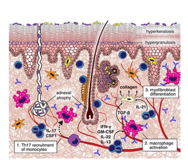 cGvHD process