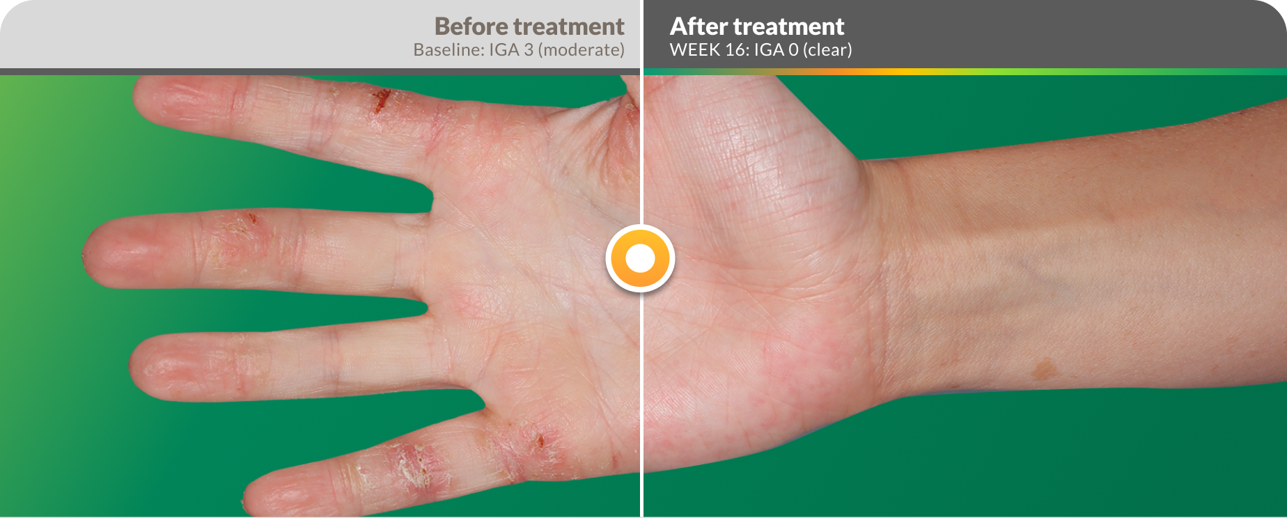 efficacy-before-after-hands
