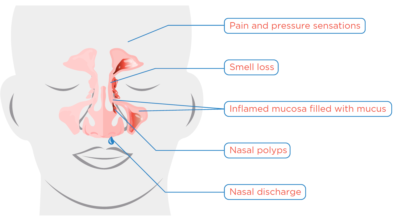 inflammatory-changes
