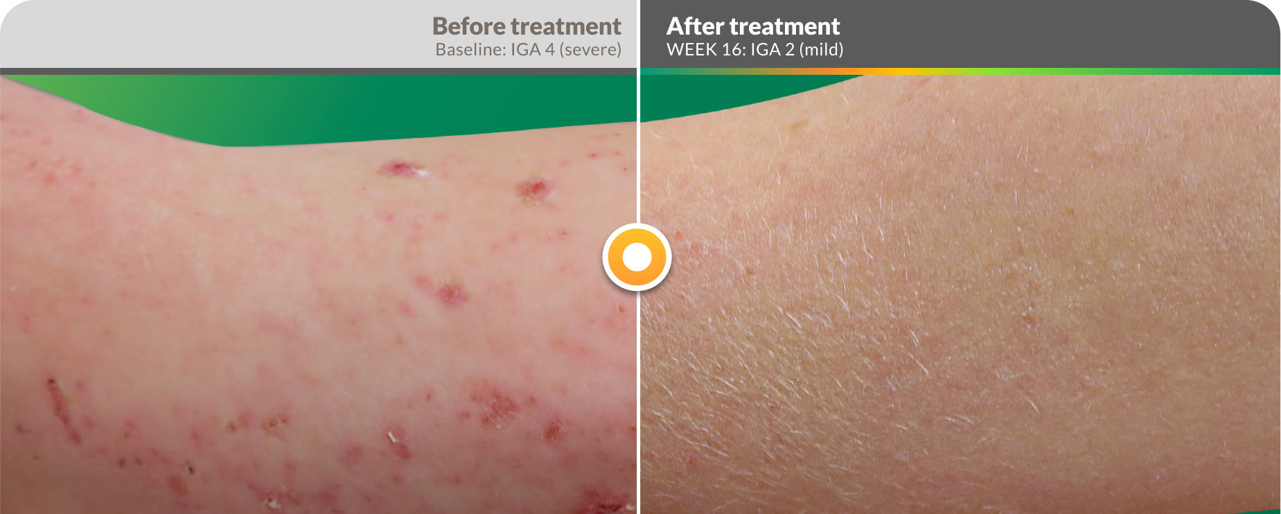 efficacy-before-after-arm