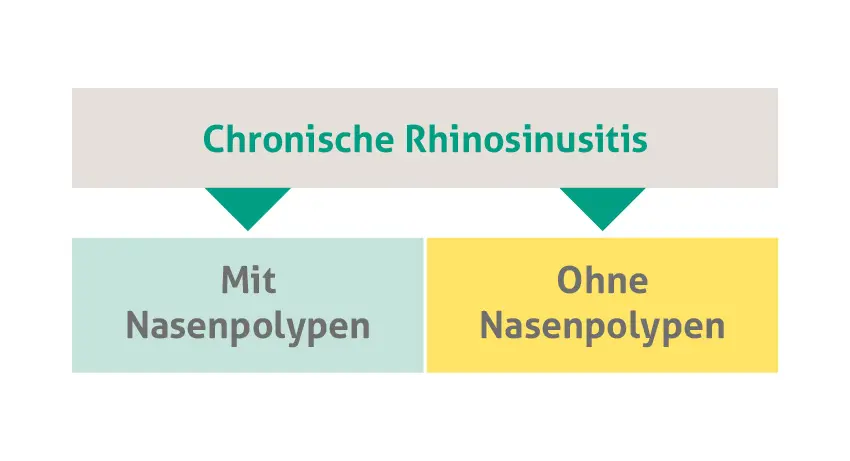 Einfaches Diagramm zur Klassifizierung der chronischen Rhinosinusitis. Oben steht der Haupttitel "Chronische Rhinosinusitis", darunter befinden sich zwei Kästchen: links ein hellgrünes mit der Beschriftung "Mit Nasenpolypen" und rechts ein gelbes mit der Beschriftung "Ohne Nasenpolypen".